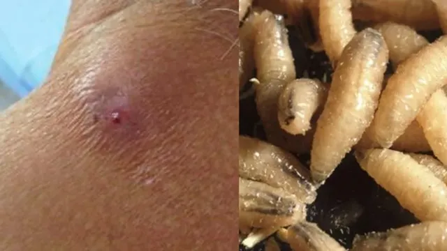 gusano